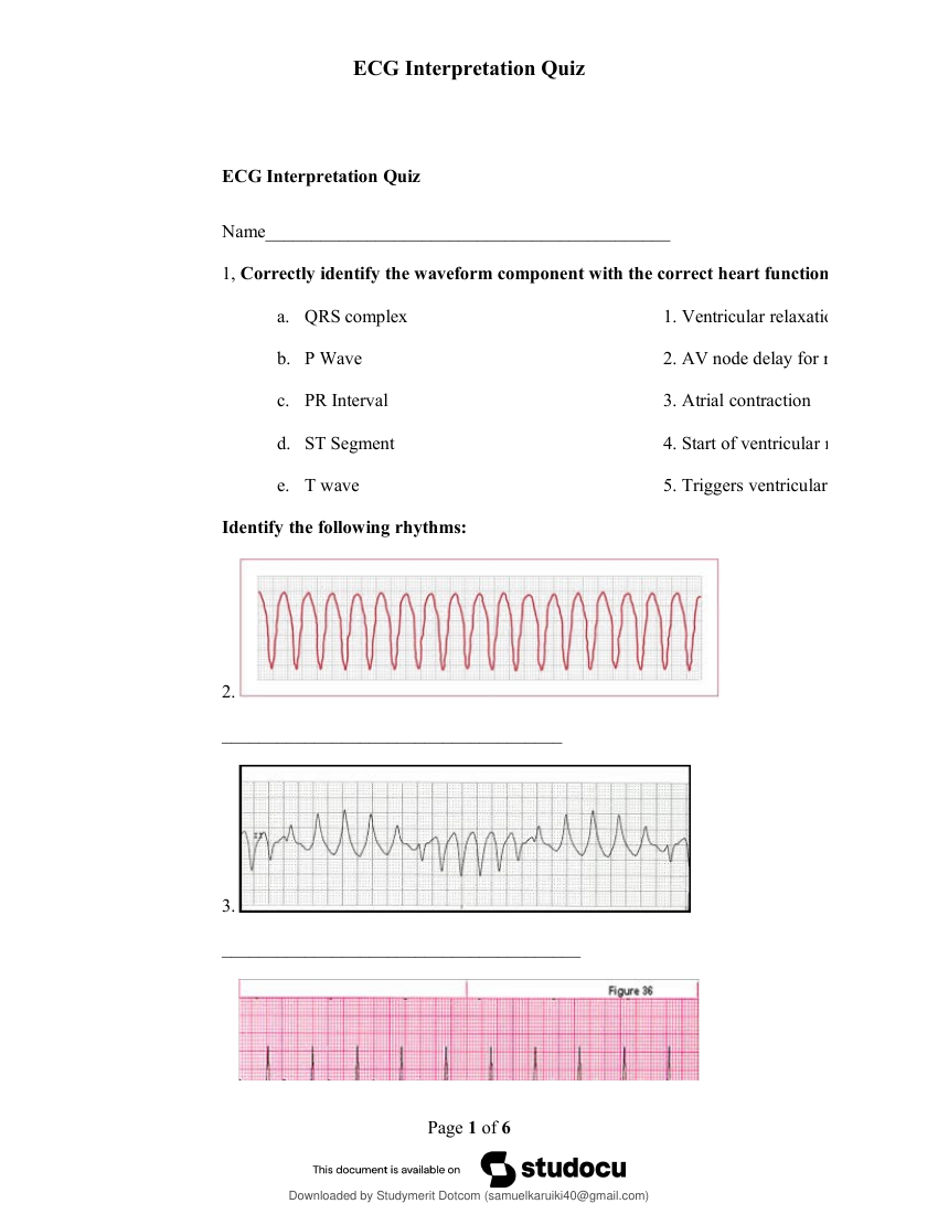 HCA ECG Test Exam With Answers 2024/2025
