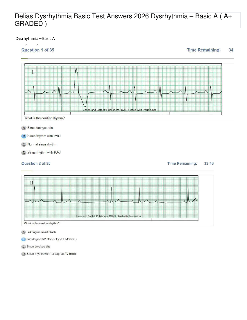 Relias Dysrhythmia Basic Test 35 Questions and Answers 2023 (Basic A Dysrhythmia)