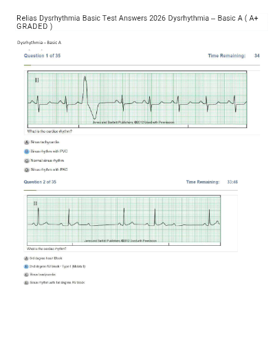 Relias Dysrhythmia Basic Test Answers 2026/2027 Dysrhythmia – Basic A ( A+ GRADED 100% VERIFIED)