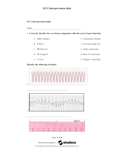 hca ecg test exam updated 2026