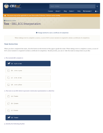 HCA ECG/EKG Test Exam with Answers, HCA Healthcare Telemetry Competency Assessment, 2026/2027